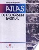 Atlas De Ecografía Vaginal