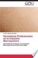 Dermatosis Profesionales En La Industria Marroquinera