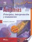 Arritmias