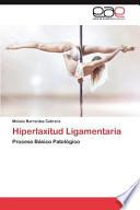 Hiperlaxitud Ligamentaria