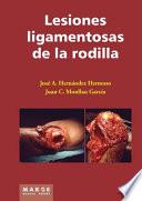 Lesiones Ligamentosas De La Rodilla