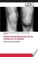 Anteromedialización De La Rótula En El Adulto