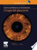 Cirugía Del Glaucoma + Dvd Rom