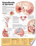 Entendiendo Que Es Un Derrame / Understanding Stroke Anatomical Chart