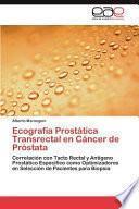 Ecografía Prostática Transrectal En Cáncer De Próstata