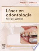 Láser En Odontología