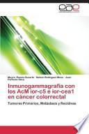 Inmunogammagrafía Con Los Acm Ior C5 E Ior Cea1 En Cáncer Colorrectal